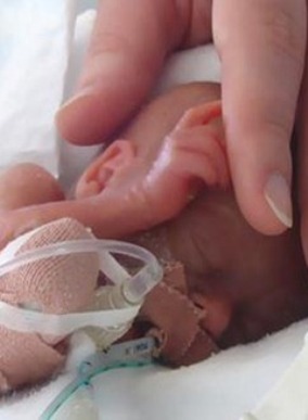 bimbi-prematuri-controlli-da-fare-dopo-la-nascita